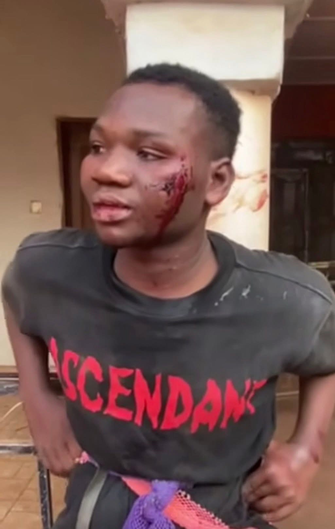 Young man beaten for having sex with a married woman
