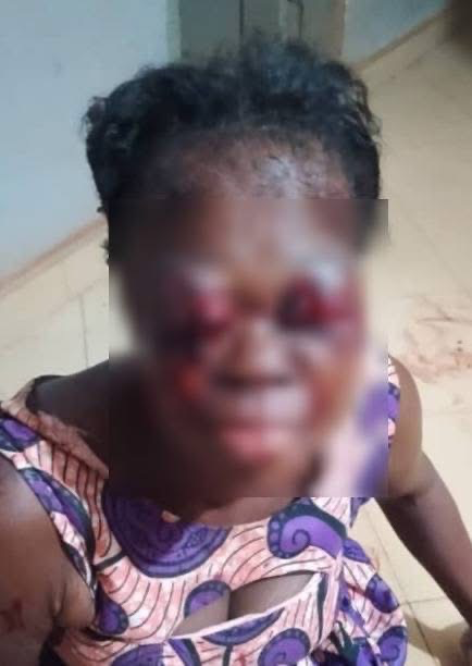 Man Arrested After Brutal Eye-Stabbing in Domestic Dispute in Sefwi Abrokofe