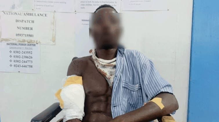 Police Investigate Cutlass Attack on 25-Year-Old Man at Nzema Nkwanta