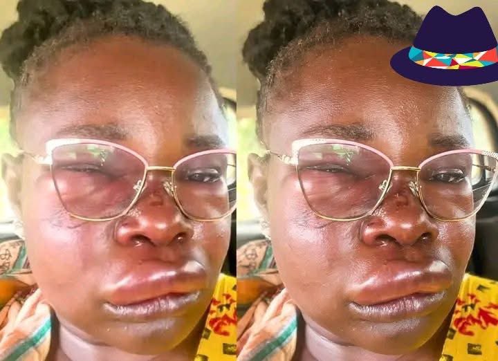 Domestic Violence Erupts: Husband Allegedly Assaults Wife for Refusing Sex After Long Shift
