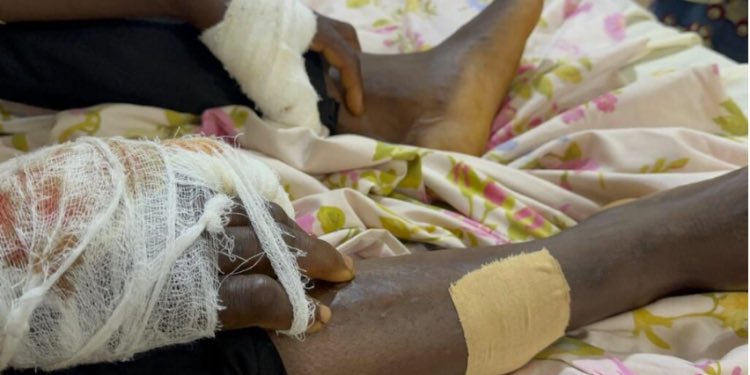 Prison Officers, Inmates Attack Man with Machetes at Kenyasi Settlement Camp
