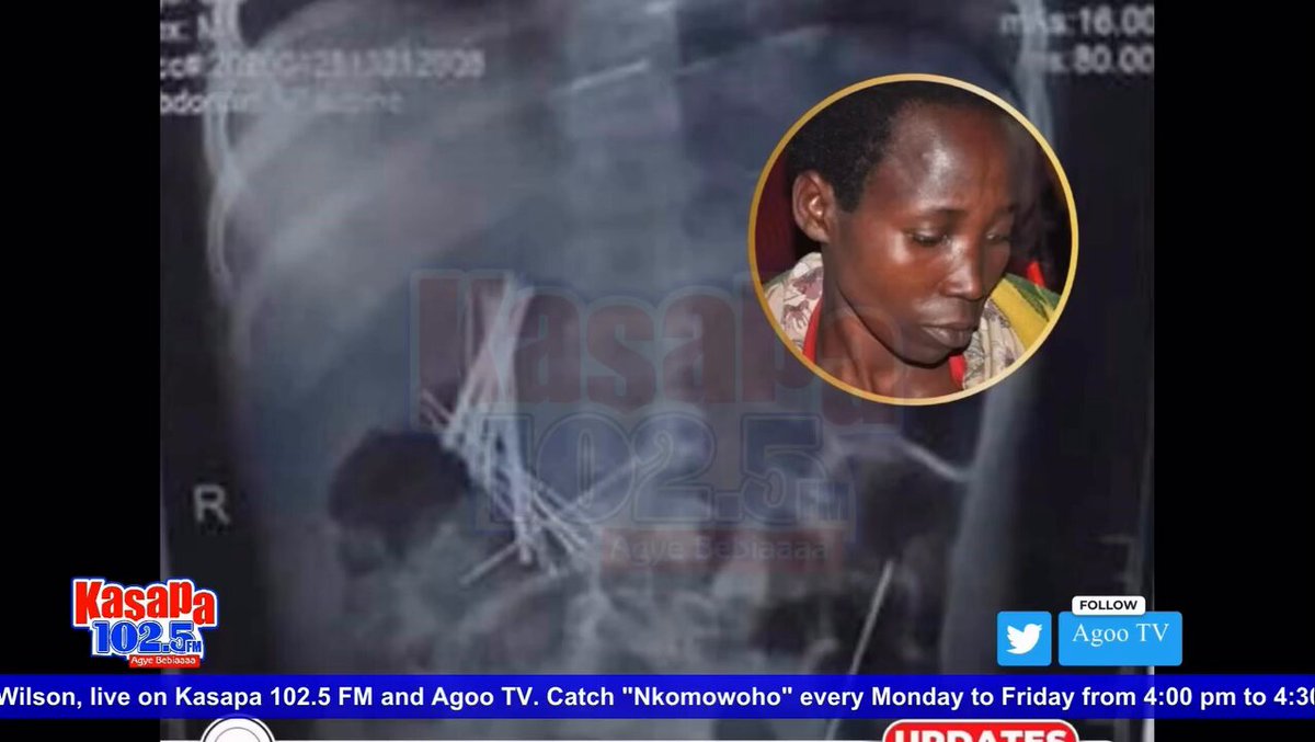 Shocking Abuse: Stepfather Accused of Forcing Stepdaughter to Swallow Pins in Ghana