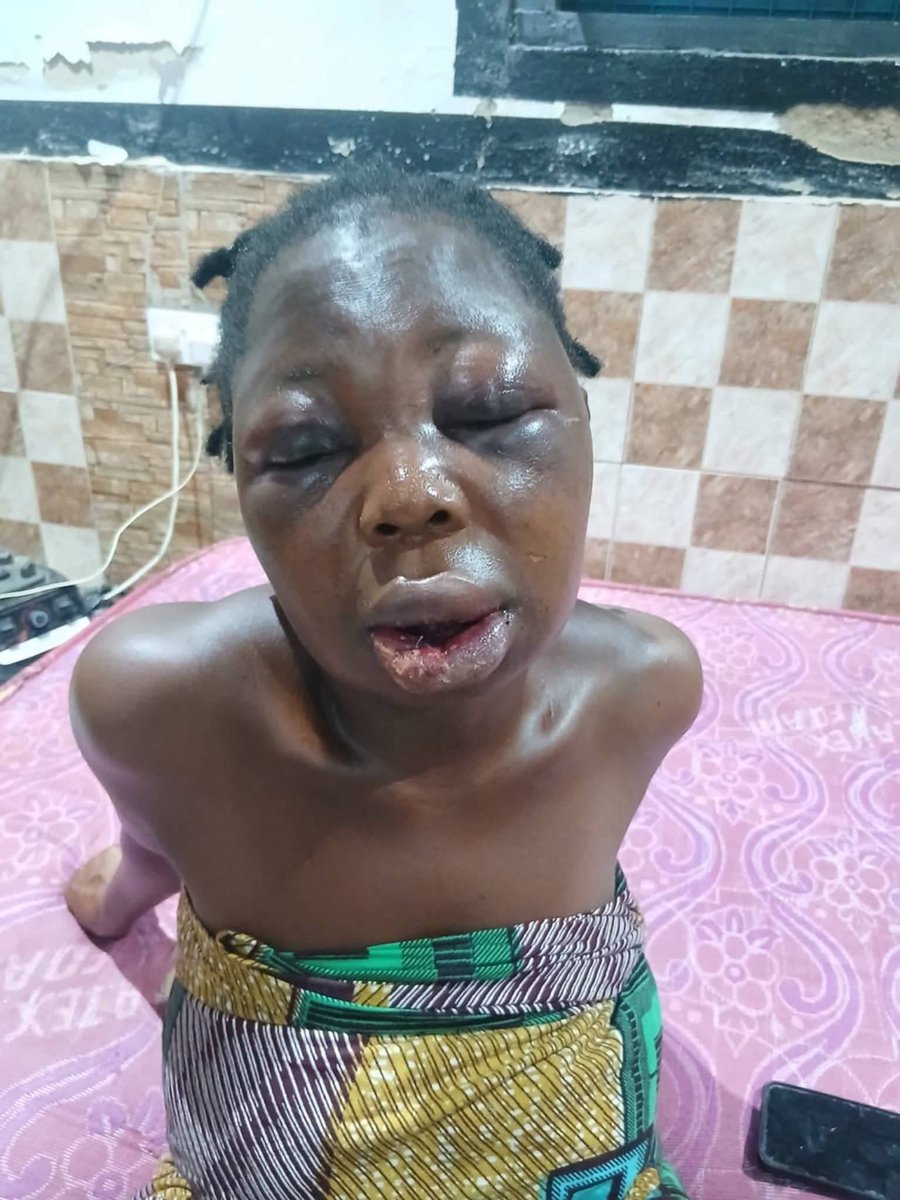 Wife Beaten Unconscious by Husband's Alleged Lover After Confrontation